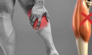 Dolore al polpaccio, con un'area rossa che indica una lesione al soleo. Tempi di recupero lunghi per questo tipo di infortunio.
