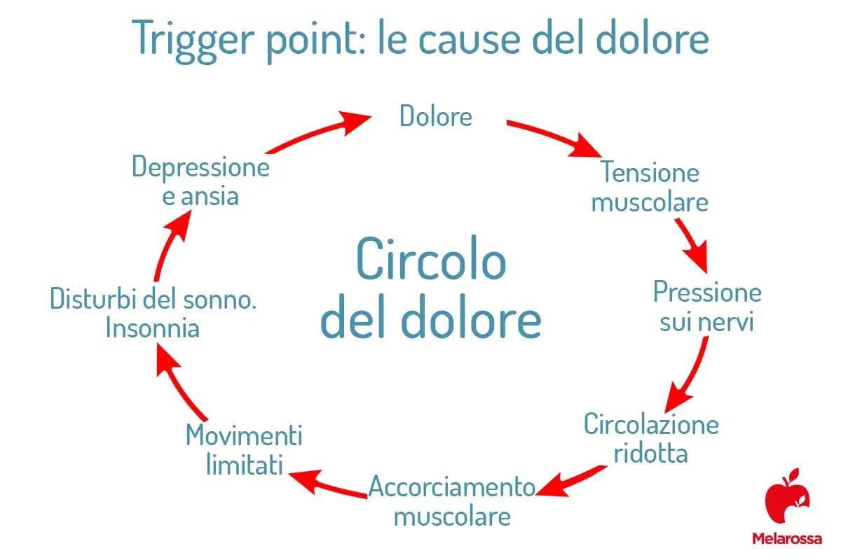 Mappa del circolo del dolore: trigger point, tensione muscolare, pressione sui nervi, circolazione ridotta, accorciamento muscolare, movimenti limitati, disturbi del sonno, depressione e ansia.