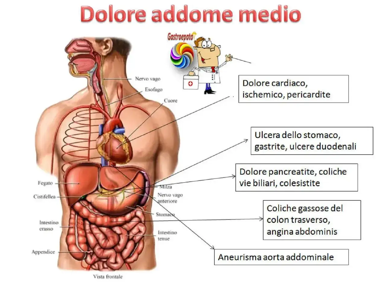 Mappa dei dolori addominali: illustra le cause di dolore al torace, stomaco, pancreas, vie biliari e aorta.