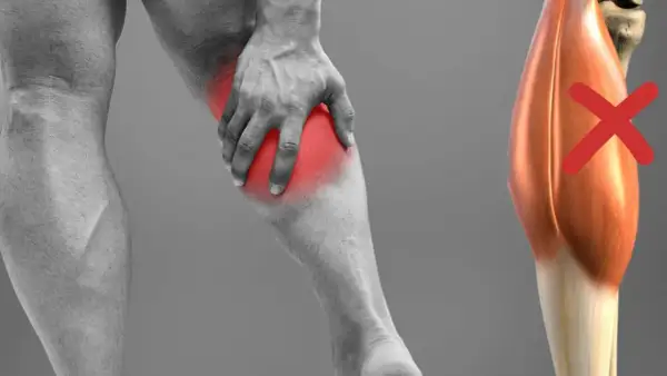 Dolore al polpaccio, con un'area rossa che indica una lesione al soleo. Tempi di recupero lunghi per questo tipo di infortunio.